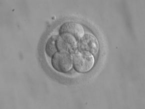 Embrión humano tres días después de la fertilización. Imagen: Wikipedia
