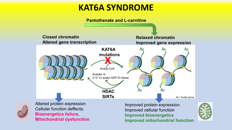 síndrome KAT6A