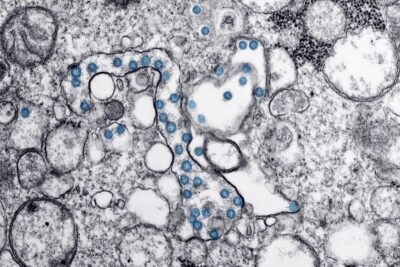 Partículas del virus SARS-CoV-2, coloreadas en azul, en una imagen de microscopio de electrones. / CDC