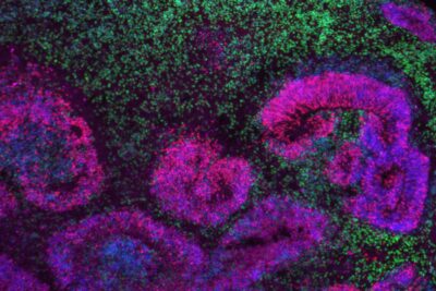 Fotografía ilustrativa del artículo