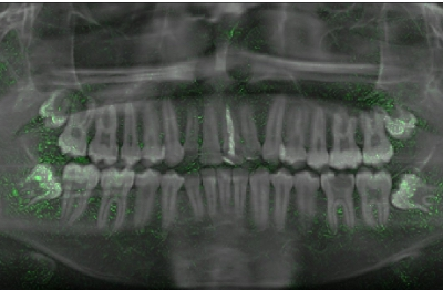Fotografía ilustrativa del artículo